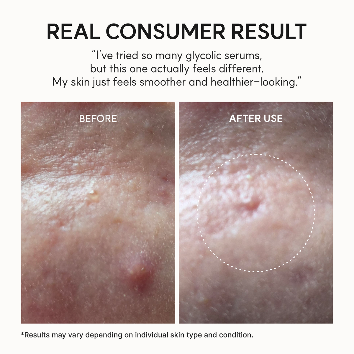 Arencia Eraser Shot Glycolic Acid Booster, Daily Clarifying Multi-Acid Formula for Smoother, Clear-Looking Skin 30ml