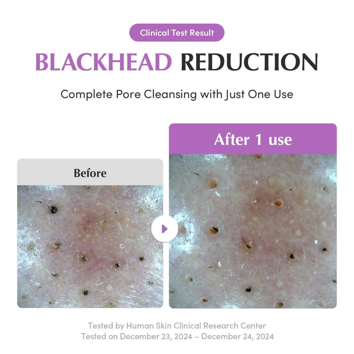EQQUALBERRY Purple Rice Pore Purifying Pack Cleanser 130g