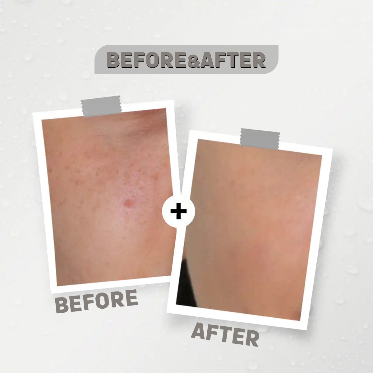 Alpha Arbutin + Niacinamide 12% + Zinc 1% Serum