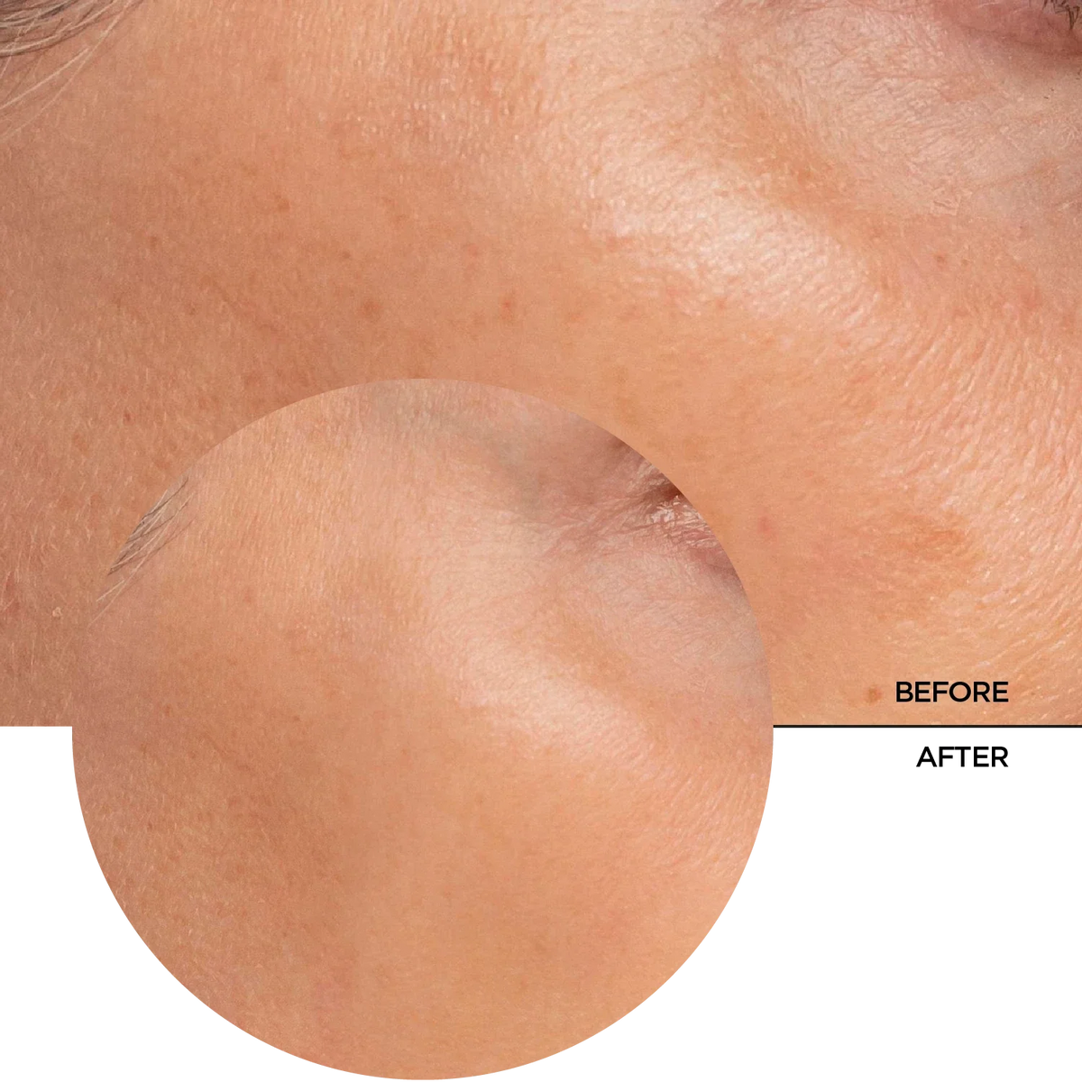 REVOX B77 JUST Alpha Arbutin 2% + HA 30ml
