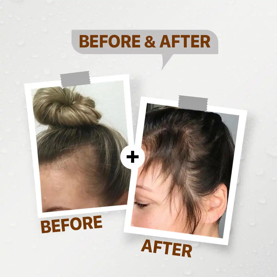 FirstVoc Anti-Hair Loss Ampoules