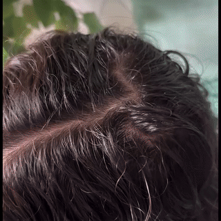 KERAHAIR LOTION best hair growth lotion