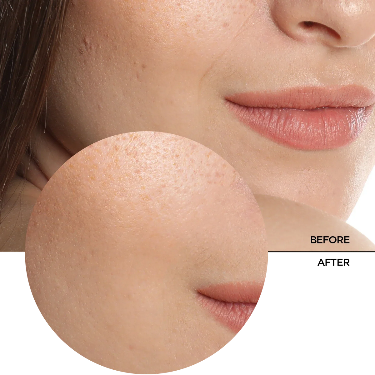 REVOX B77 JUST Hyaluronic Acid 5% 30ml