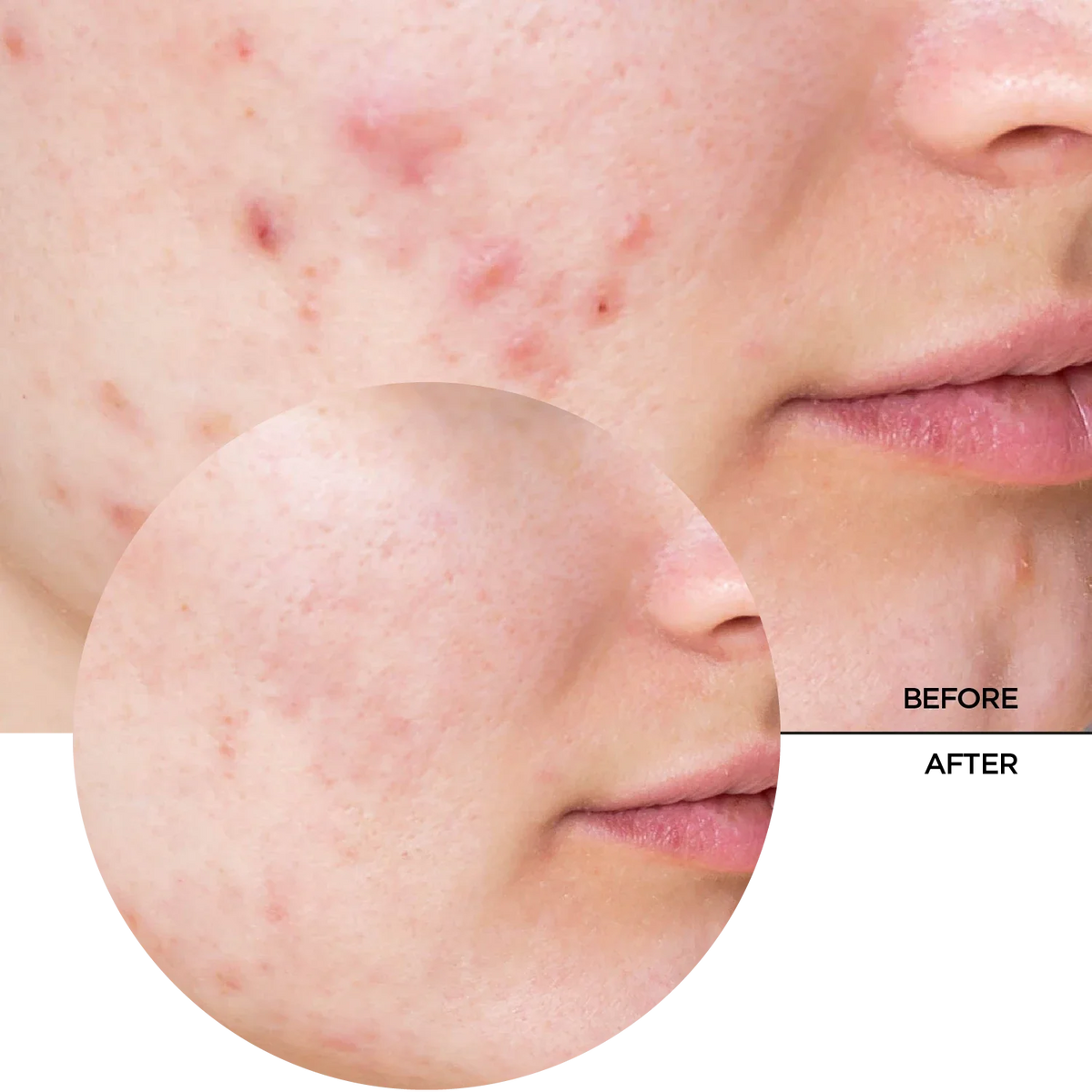 REVOX B77 JUST Niacinamide 10% 30ml