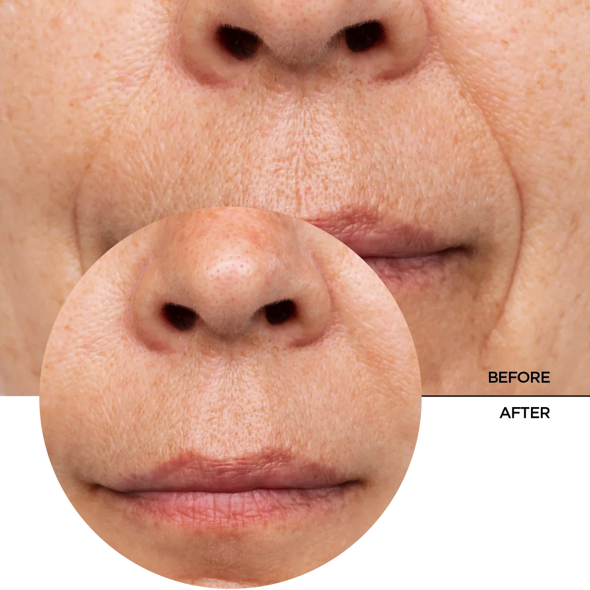 REVOX B77 JUST Retinol in Squalane 30ml